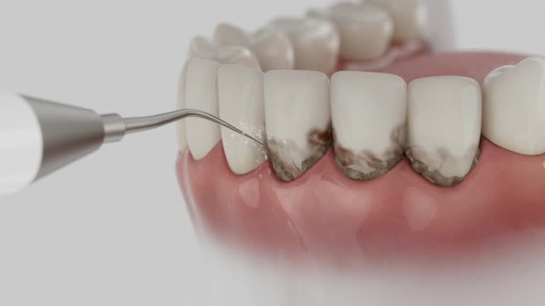 Trusted Teeth Cleaning And Checkup service in East Mountain, TX - Dentist Open Now
